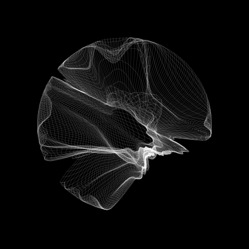 Vinildən Rəqəmsala